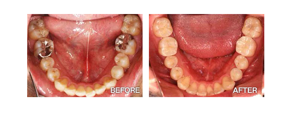 岐阜市の歯科（島栄町）「森歯科」です。【一般歯科】【小児歯科】【口腔外科】【インプラント】【自費治療】