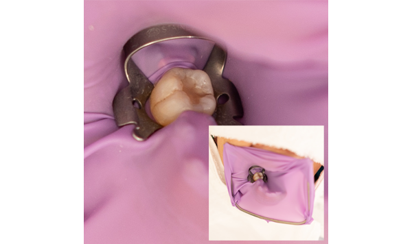 岐阜市の歯科（島栄町）「森歯科」です。【一般歯科】【小児歯科】【口腔外科】【インプラント】【自費治療】